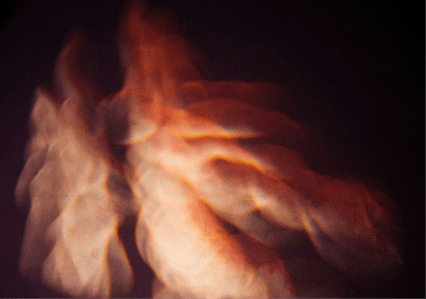 Neurodiversity and brain health