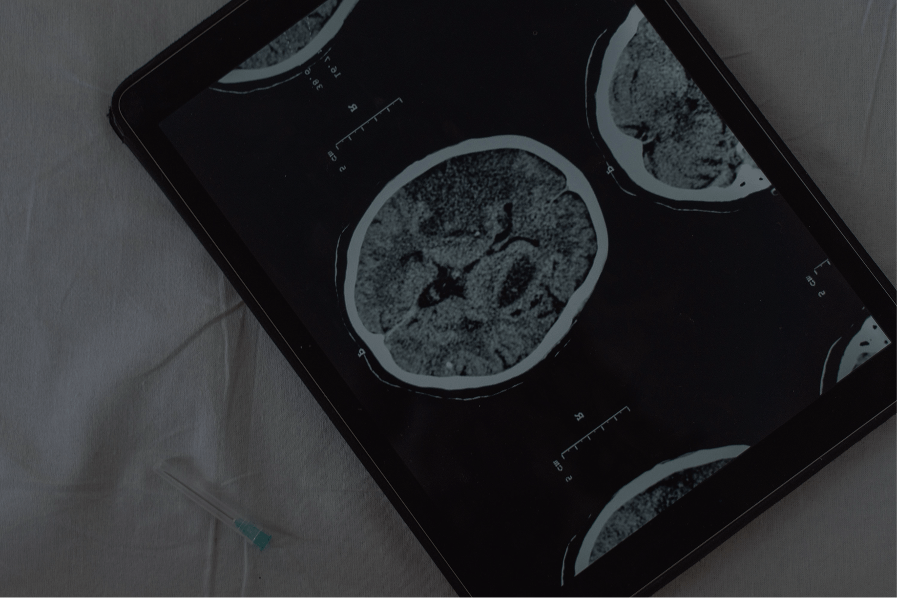 Woman experiencing PMDD symptoms