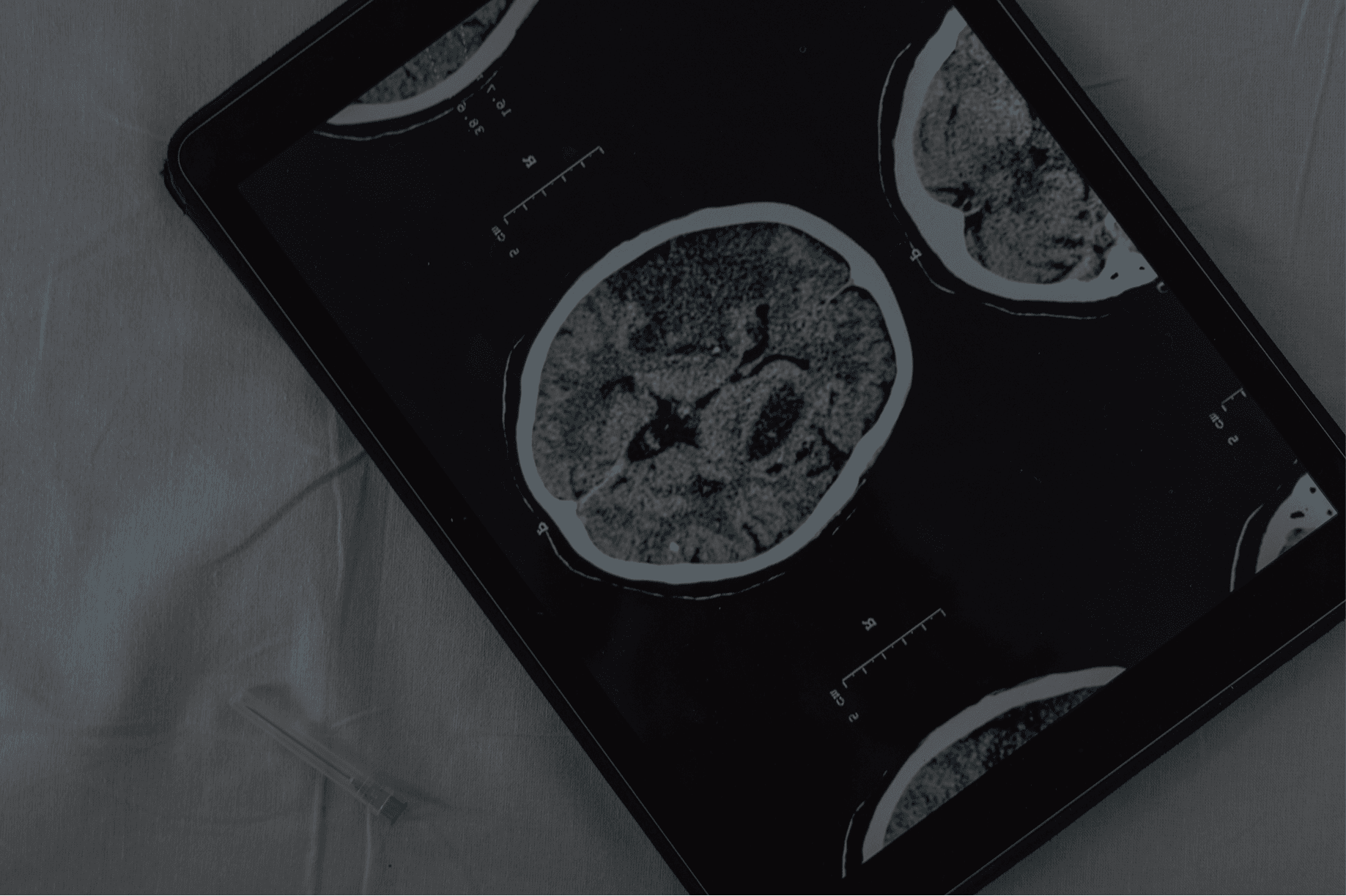 Woman experiencing PMDD symptoms