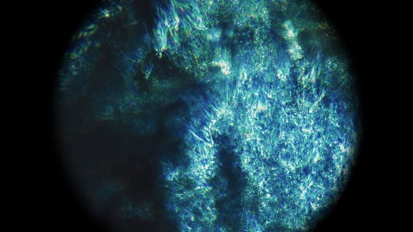 The neuroscience of endometriosis