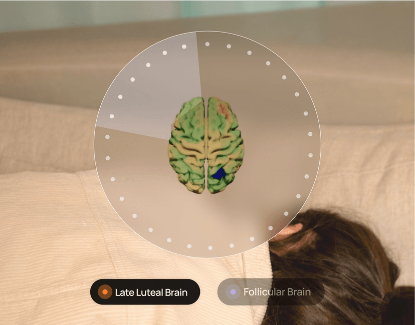 Neuroplasticity as a tool for optimizing menstrual health